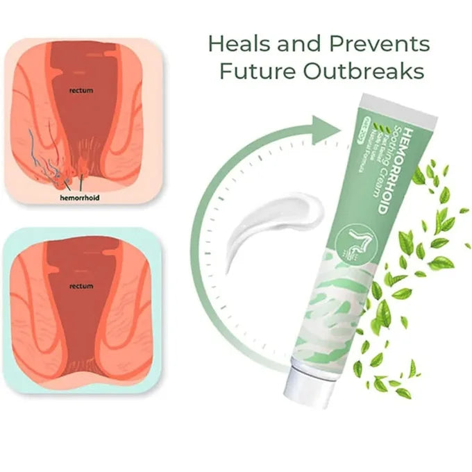 Crème à base de plantes pour hémorroïdes - Livraison a domicile - 30$