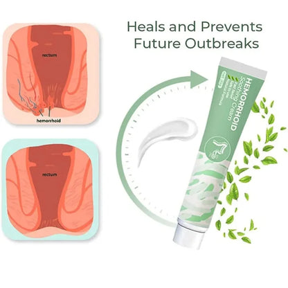 Crème à base de plantes pour hémorroïdes - Livraison a domicile - 30$