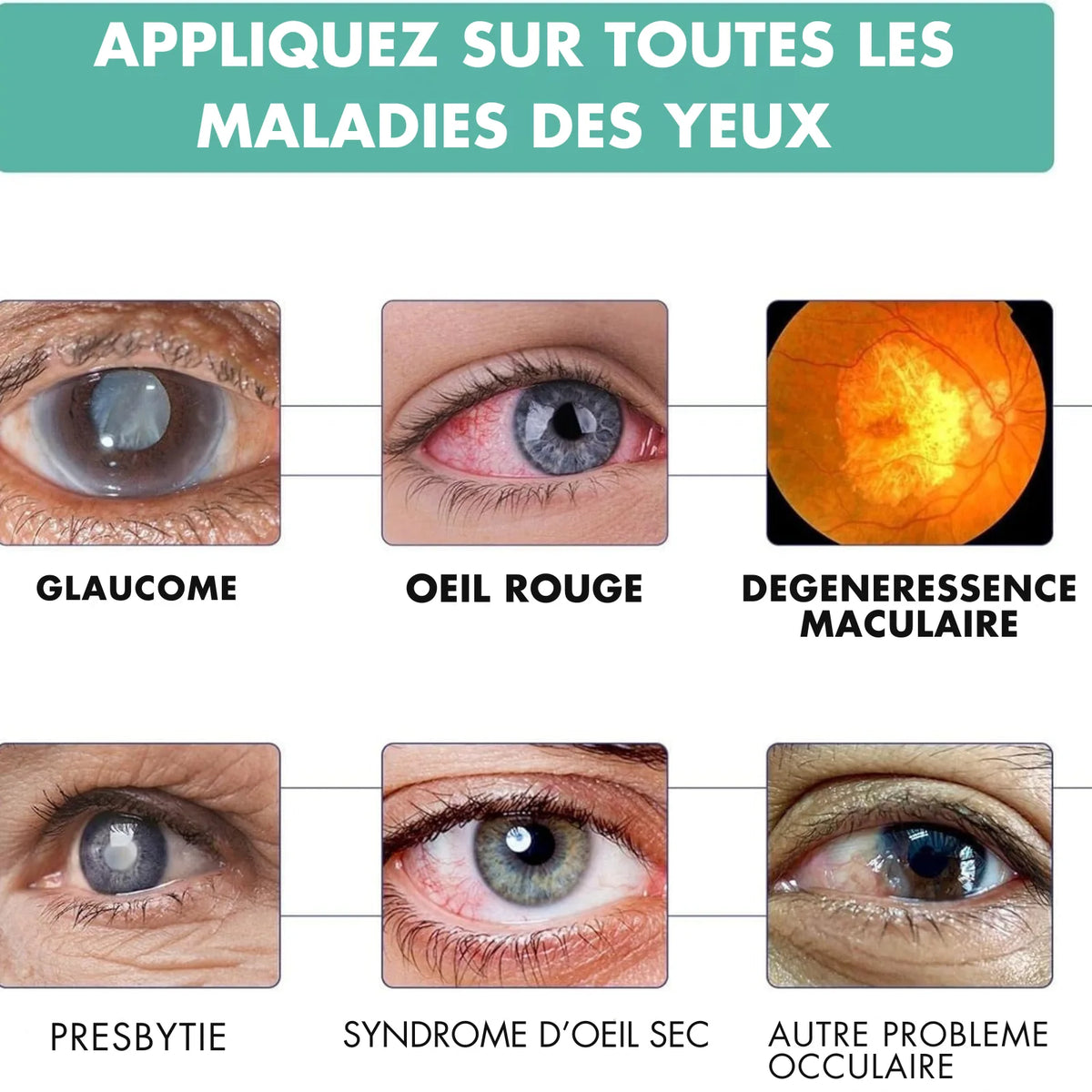 VISION ROLLER : La clarté à Vos Yeux Pour Toutes Maladies Des YEUX-Disponible a Kinshasa-Lubumbashi