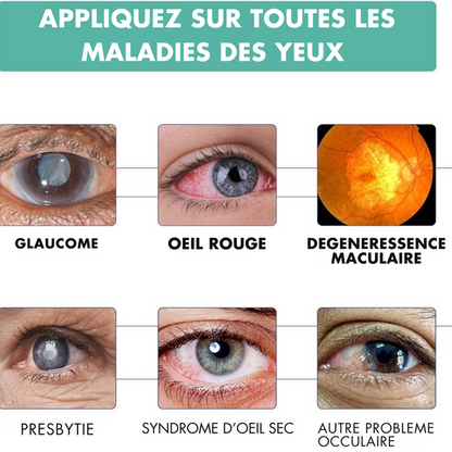 VISION ROLLER : La clarté à Vos Yeux Pour Toutes Maladies Des YEUX-Disponible a Kinshasa-Lubumbashi